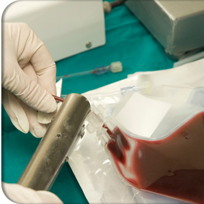 phlebotomy uk